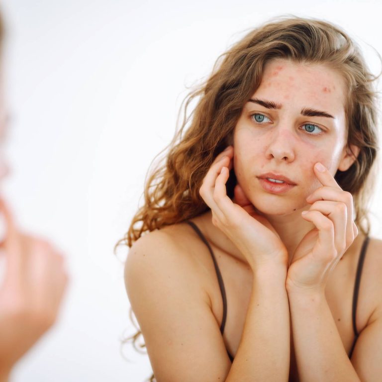 portrait-of-a-young-woman-touching-pimple-on-her-f-2026-01-09-01-15-12-utc